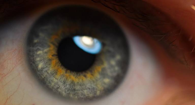 Macro d'un iris humain gris-vert montrant les fibres du stroma, la couronne orangée autour de la pupille et l'anneau limbique sombre en périphérie.
