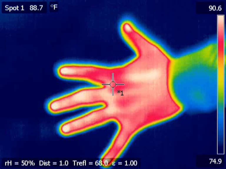 Image thermographique infrarouge d'une main humaine montrant les écarts de température entre la paume et les doigts
